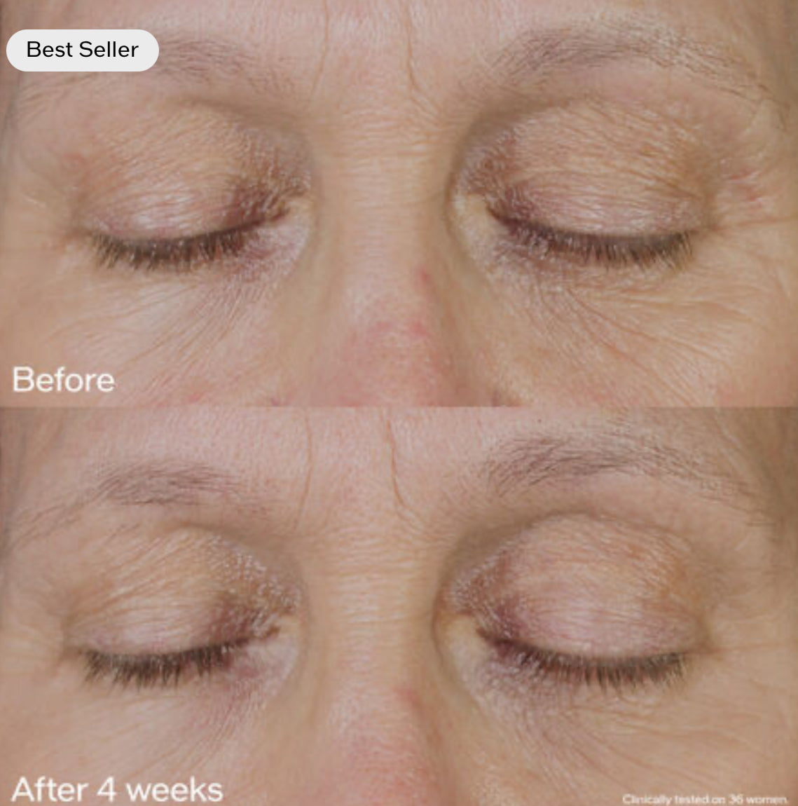 Vital Perfection Uplifting and Firming Eye Cream - by Shiseido